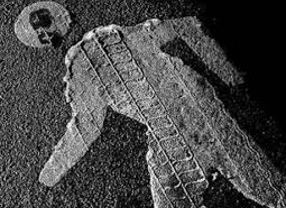 Задел человека: ответственность